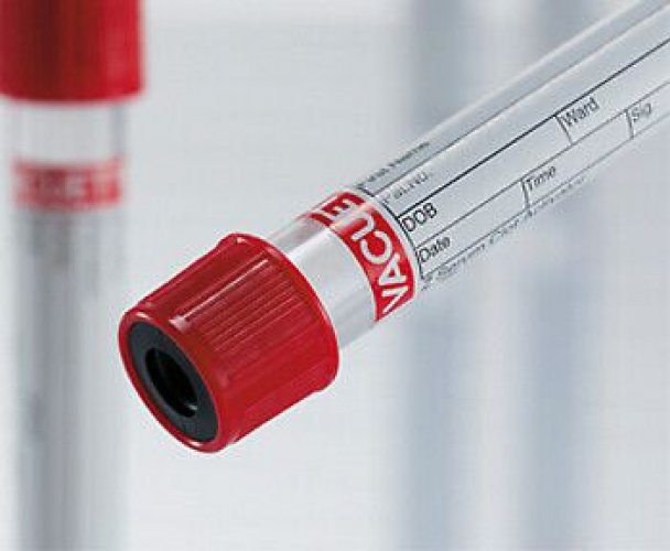 Seerumiputki Vacuette kierteetön 4ml 13x75mm